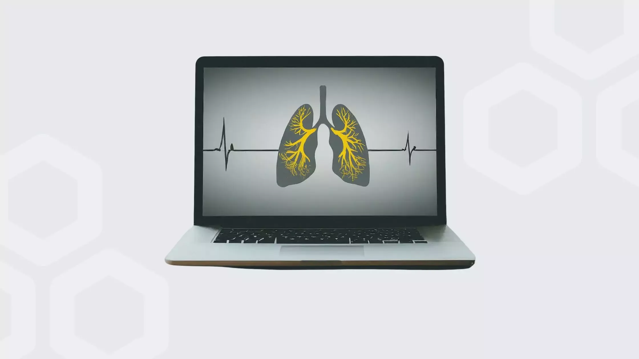 Image resource about Cost-benefit analysis of at-home COPD monitoring